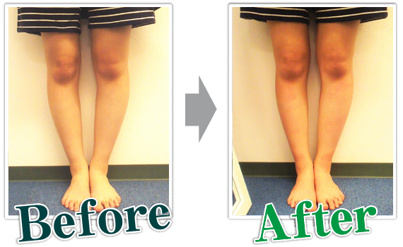 Before→After